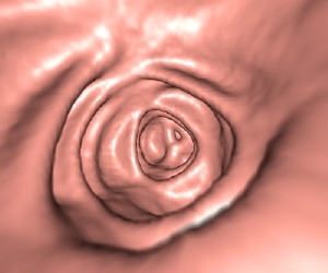 大腸CTイメージ4