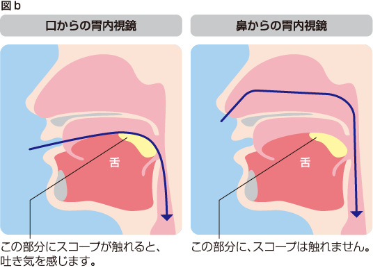 図b